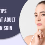 10 Tips for Treat Adult Acne on Skin