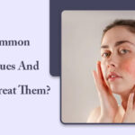 10 Common Skin Issues and How to Treat Them?