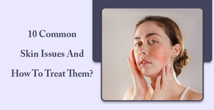 10 Common Skin Issues and How to Treat Them?