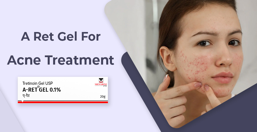 A Ret Gel For Acne Treatment