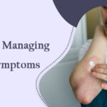 Eczema- Managing the Symptoms