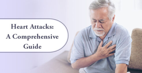 Heart Attacks: A Comprehensive Guide