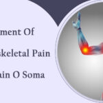 Treatment of Musculoskeletal Pain with Pain O Soma